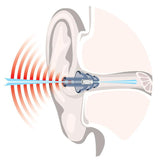 NoNoise Intelligent Hearing Protection Earplugs
